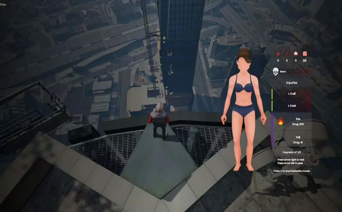 Body Damages V2 [ ESX / QBCore / STANDALONE ] FiveM Script - esx 2